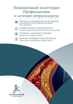 Обложка книги - Повышенный холестерин. Профилактика и лечение атеросклероза - Ян Кимаковский